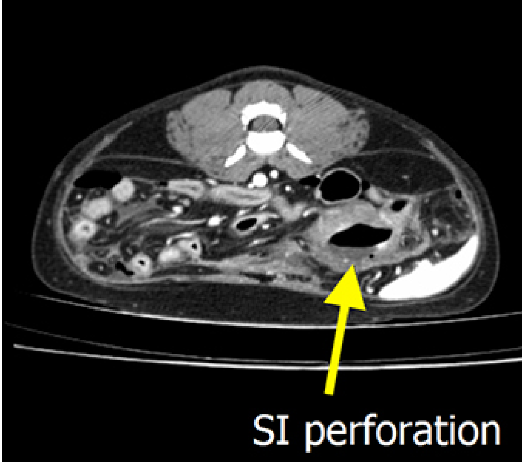 case09