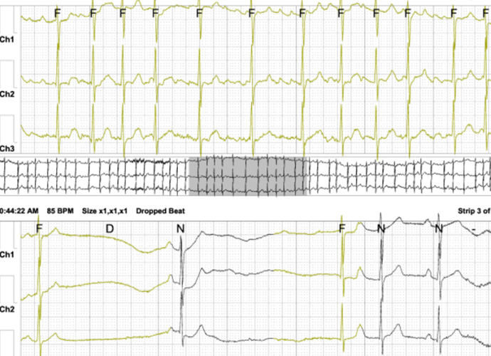 internal_medicine_img04